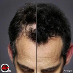 تصویر محصول